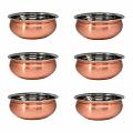 6Pcs - Copper Stainless Steel Handi Serving Dish with Lid (Plain) - 3 Sizes
